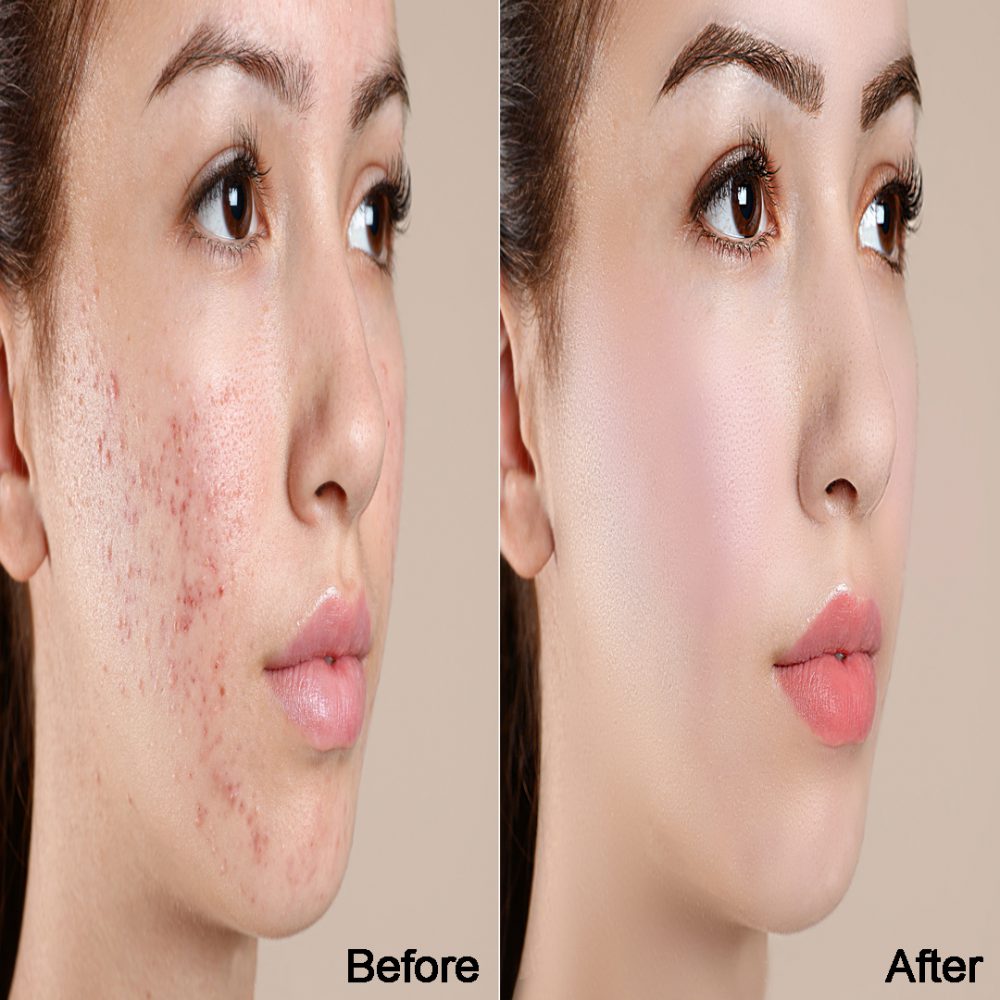 1-ادیت تخصصی عکس های پرتره