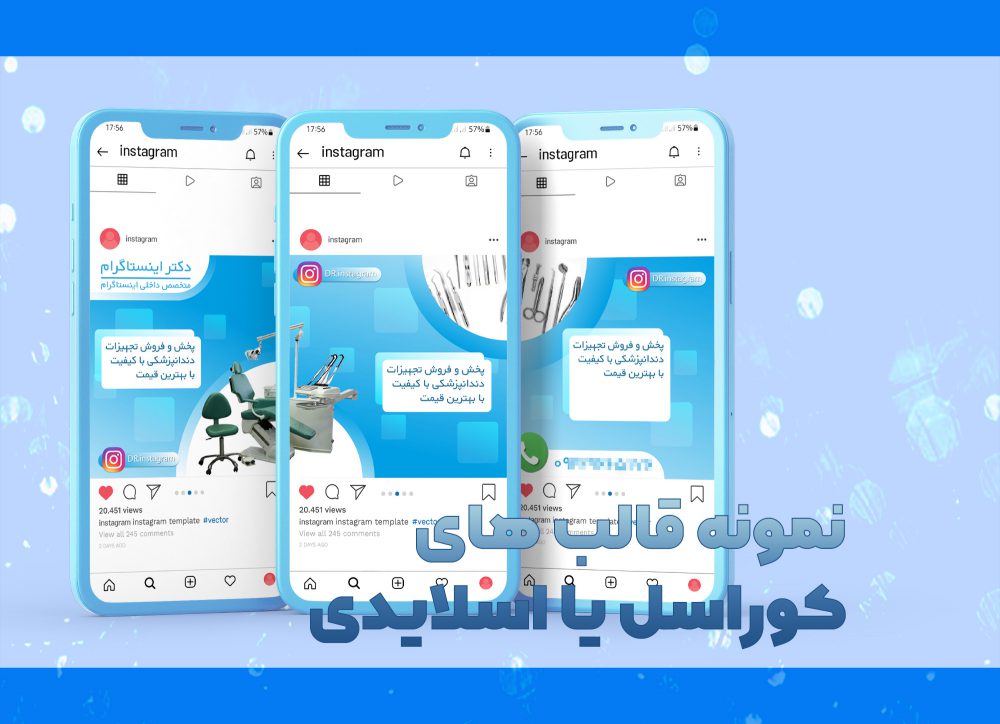 قالب های به هم متصل