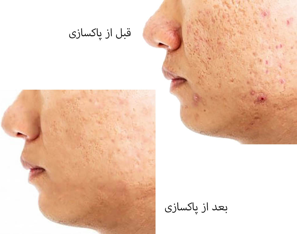 پاکسازی طبیعی صورت 1