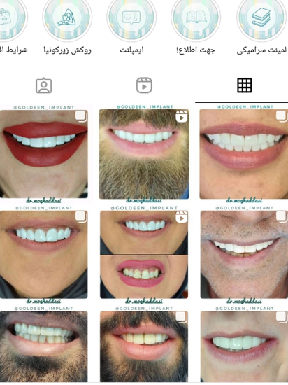 1-فروش پیج های فعال اینستا ویژه دندانپزشکان
