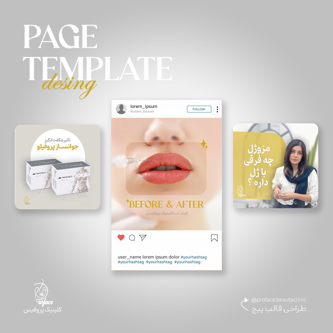 طراحی پست استوری های پیج پروفیس 