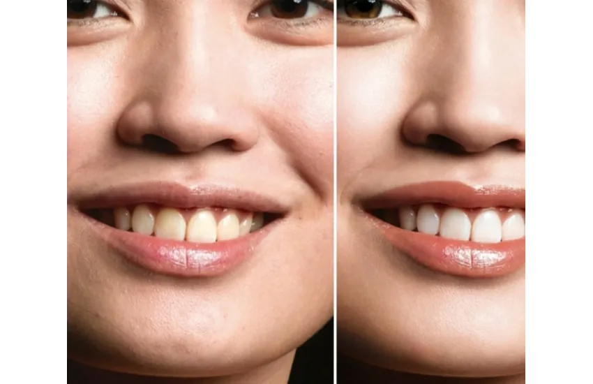 1-ریتاچ و فوتوشاپ حرفه ای