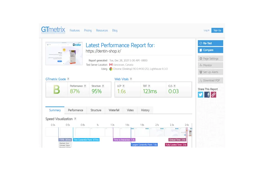 سرعت سایت دنتین