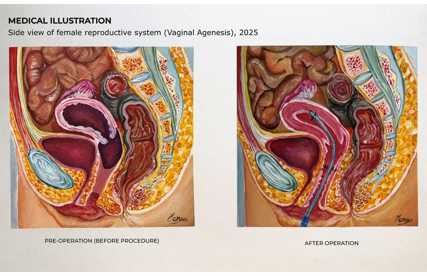 3-Medical Illustration 