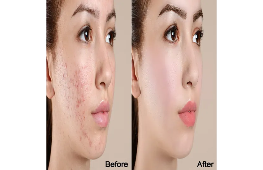 1-ادیت تخصصی عکس های پرتره